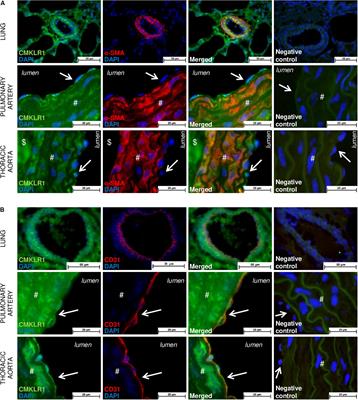 Chemerin Added to <mark class="highlighted">Endothelin-1</mark> Promotes Rat Pulmonary Artery Smooth Muscle Cell Proliferation and Migration